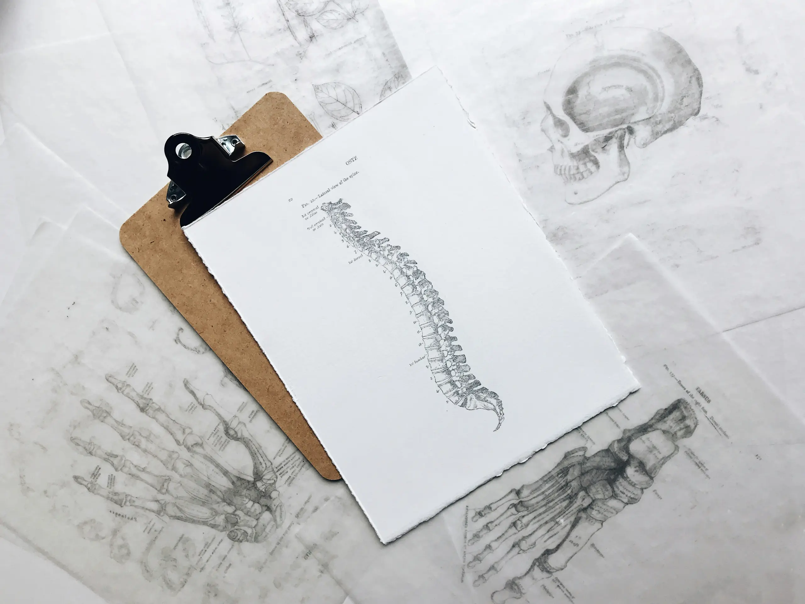 How Much is a Herniated Disc Worth in a Car Accident in New Jersey?