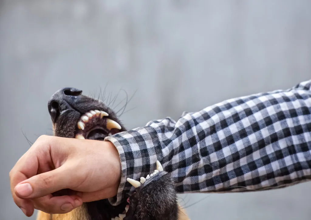 Why Choosing a Local Lawyer for a Dog Bite Case Makes a Difference
